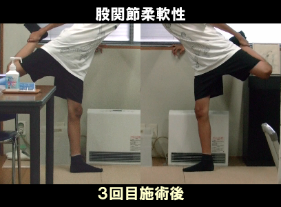 ３回目施術後：左股関節の可動制限の状態