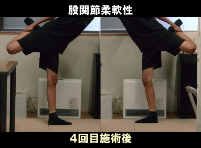 ４回目施術後：左股関節の可動制限の状態