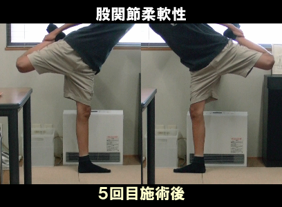 ５回目施術後：左股関節の可動制限の状態