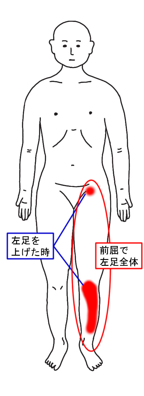 動きで発生する痛点の位置