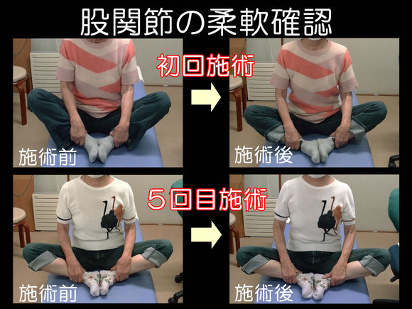 初回と５回目の股関節可動域の変化比較