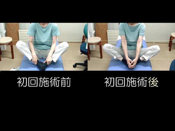 座って膝を開く時の股関節可動域が向上した比較写真