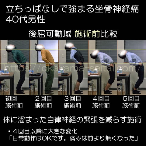 ３回の施術で後屈可動域が明確に変化し日常の痛みと比例している