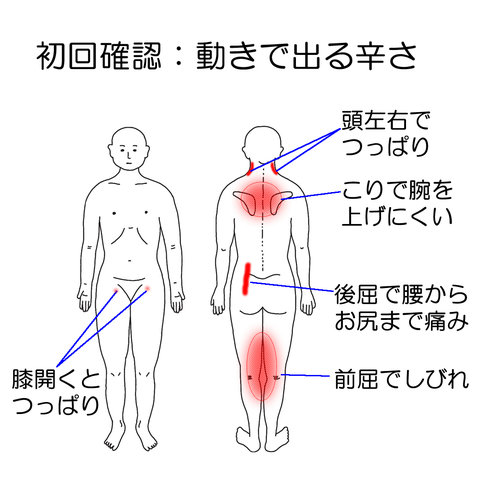 初回施術前の動きに連動する不調の確認