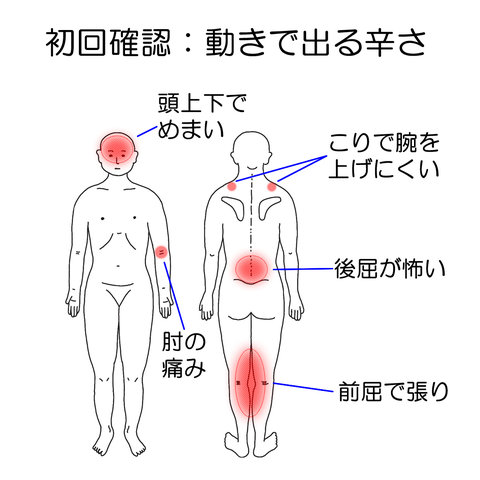 初回施術前の動きに連動する不調の確認